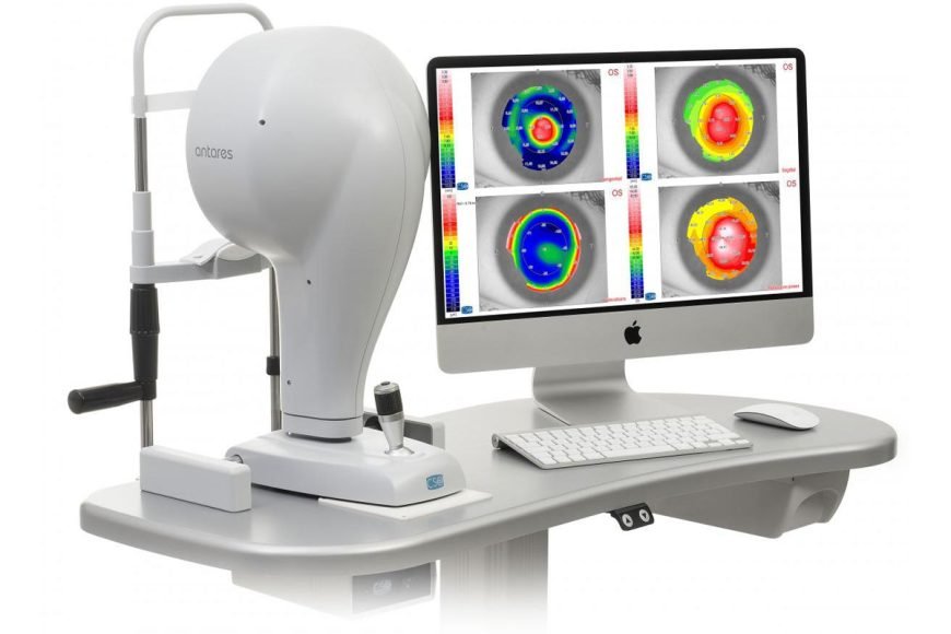 Tomografia Corneale Casia 2